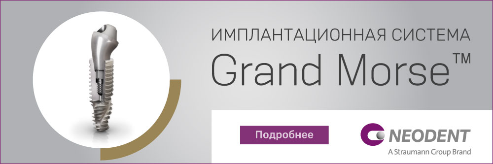 Импланты Neodent Томск Приозерная Лечение периостита Томск Яковлева